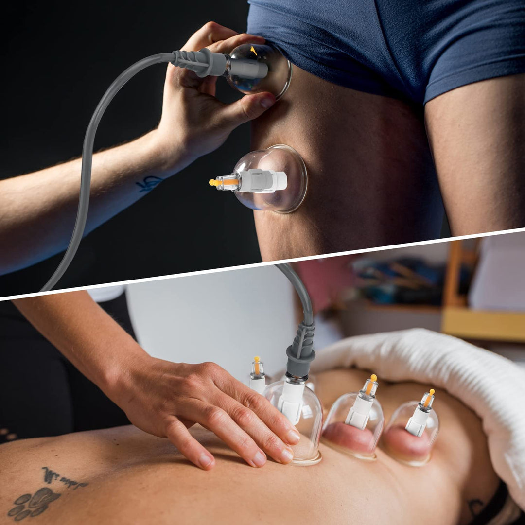 Premium Cupping Therapy Set – Vacuum Suction Massage Cups for Body, Anti-Cellulite, Pain Relief, Deep Tissue Muscle 