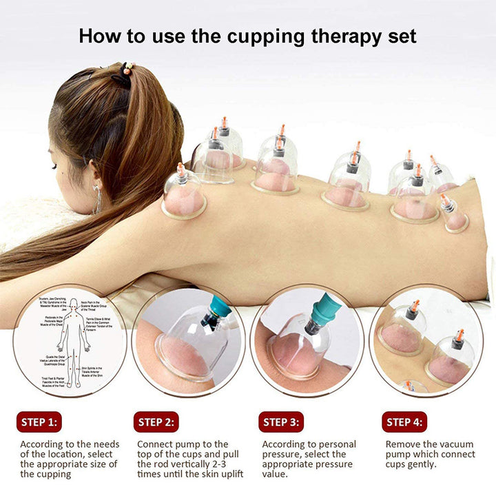 Premium Vacuum Cupping Therapy Set – 6, 12, or 24 Plastic Suction Cups for Massage, Relaxing Muscles, Pain Relief