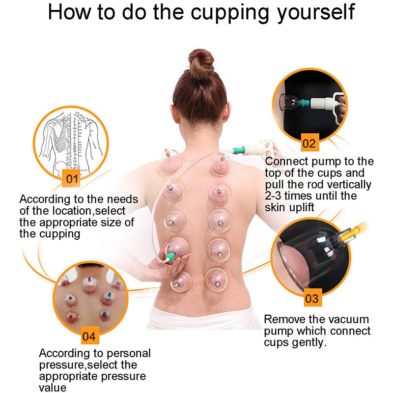 Premium Vacuum Cupping Therapy Set – 6, 12, or 24 Plastic Suction Cups for Massage, Relaxing Muscles, Pain Relief