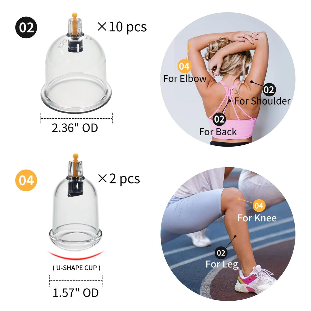 Premium Cupping Therapy Set – Professional Vacuum Suction Cups for Chinese Medicine Physiotherapy, Massage, and Muscle