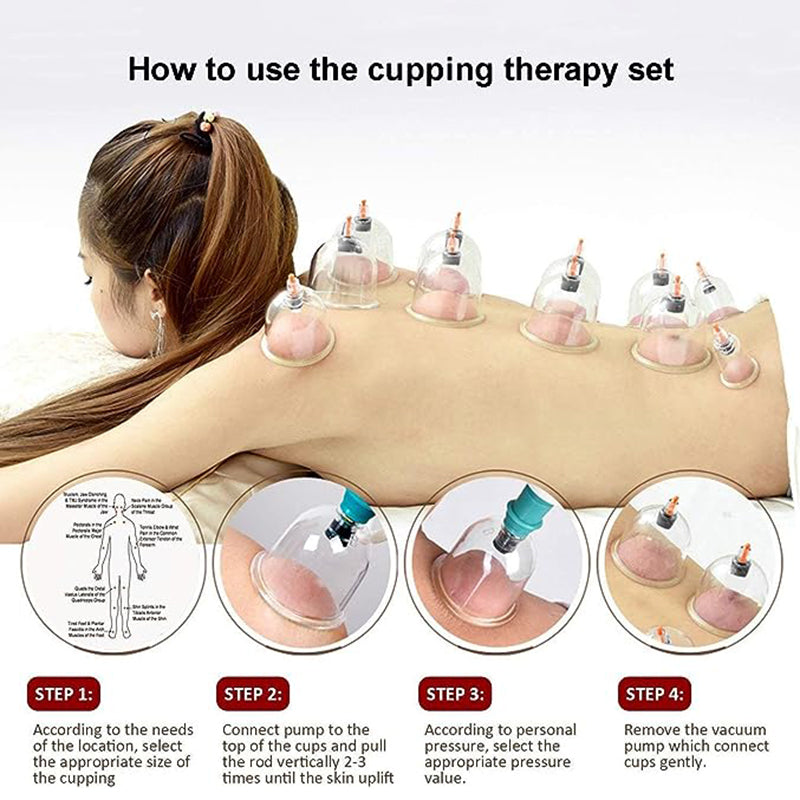 Premium Cupping Therapy Set – Vacuum Suction Cups for Massage, Anti-Cellulite, and Physiotherapy, Relieves Back, Neck