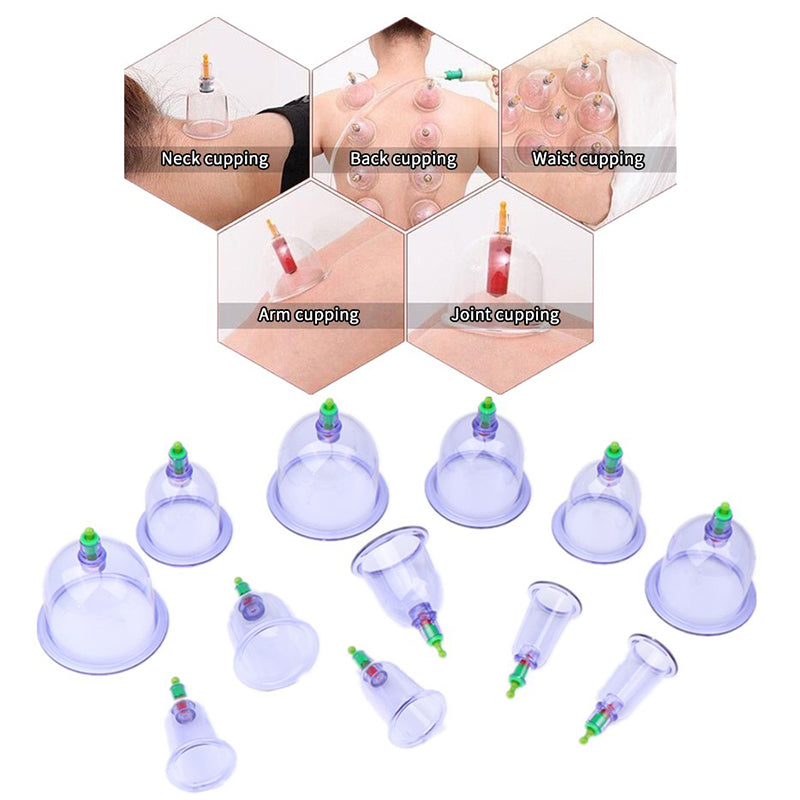 Premium Vacuum Cupping Therapy Set – 6, 12, or 24 Plastic Suction Cups for Massage, Relaxing Muscles, Pain Relief