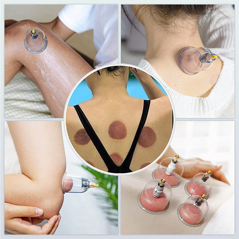 Premium Vacuum Cupping Therapy Set – 6, 12, or 24 Plastic Suction Cups for Massage, Relaxing Muscles, Pain Relief