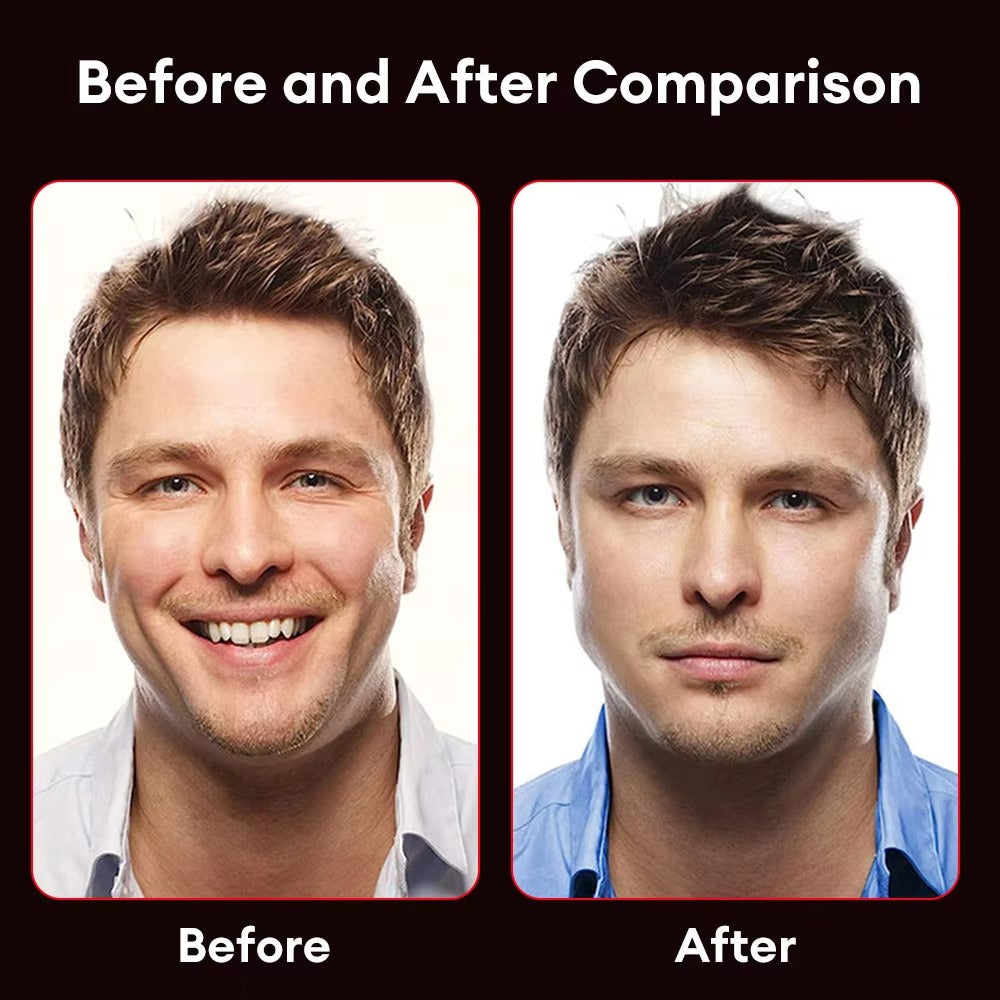 Premium Jawline Exerciser – Silicone Masseter Muscle Trainer for Facial Toner & Chin Lifting – Cheek & Jawline Fitness Equipment for Double Chin, Jawline & Face Shape Improvement - StrengthXPhysiotherapy